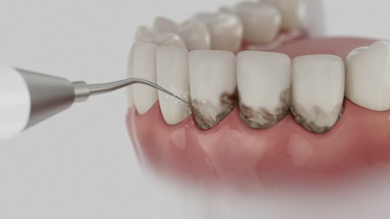 Reliable Dental Implants contractor in Rockvale, TN by Smile Center Dentistry